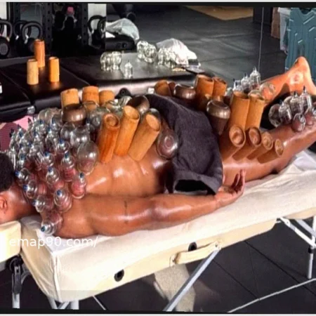 Lois Openda’s Viral Photo: Why the Footballer is Covered in Cupping Marks